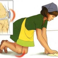 Бурсит коленного сустава симптомы и лечение с фото