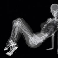 Что нужно для укрепления костей и суставов