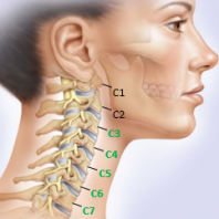 Шейный остеохондроз симптомы и лечение дома